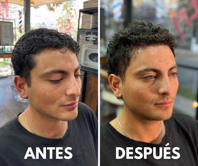 Ondulación - Antes y Después